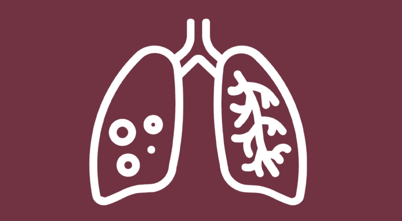 15 Early Symptoms of Sarcoidosis